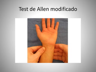 Test de Allen modificado
 