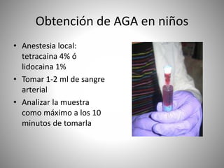 Obtención de AGA en niños
• Anestesia local:
tetracaina 4% ó
lidocaina 1%
• Tomar 1-2 ml de sangre
arterial
• Analizar la muestra
como máximo a los 10
minutos de tomarla
 