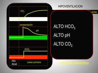 CO ₂ y pH cambian en direcciones opuestas
Lesion primaria
compensación
pH
HCO3
CO2
Alcalosis metabólica
HIPOVENTILACION
BICARB y pH cambian
en la misma dirección
ALTO HCO3
ALTO pH
ALTO CO2
Alto
Alcali
 