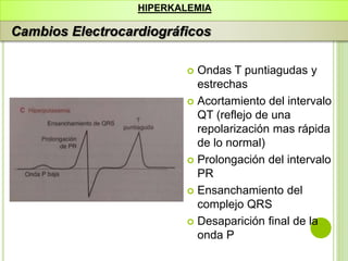  Ondas T puntiagudas y
estrechas
 Acortamiento del intervalo
QT (reflejo de una
repolarización mas rápida
de lo normal)
 Prolongación del intervalo
PR
 Ensanchamiento del
complejo QRS
 Desaparición final de la
onda P
HIPERKALEMIA
Cambios Electrocardiográficos
 