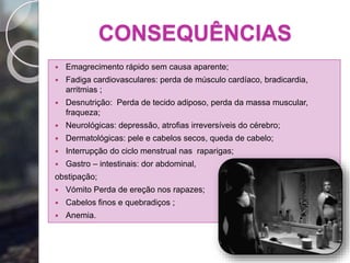 CONSEQUÊNCIAS
 Emagrecimento rápido sem causa aparente;
 Fadiga cardiovasculares: perda de músculo cardíaco, bradicardia,
arritmias ;
 Desnutrição: Perda de tecido adiposo, perda da massa muscular,
fraqueza;
 Neurológicas: depressão, atrofias irreversíveis do cérebro;
 Dermatológicas: pele e cabelos secos, queda de cabelo;
 Interrupção do ciclo menstrual nas raparigas;
 Gastro – intestinais: dor abdominal,
obstipação;
 Vómito Perda de ereção nos rapazes;
 Cabelos finos e quebradiços ;
 Anemia.
 