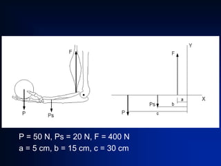 P = 50 N, Ps = 20 N, F = 400 N
a = 5 cm, b = 15 cm, c = 30 cm

 