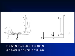 P = 50 N, Ps = 20 N, F = 400 N
a = 5 cm, b = 15 cm, c = 30 cm
 