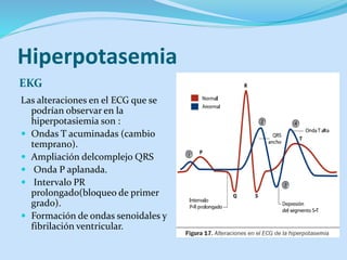 Hiperpotasemia
El tratamiento dependerá de la gravedad de la
hiperpotasemia:
 Moderada: se utilizan resinas de intercambi...