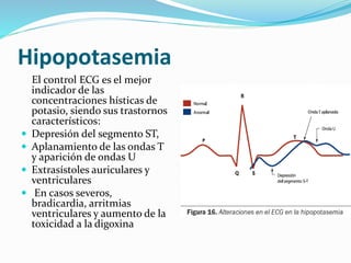 Hipopotasemia
 