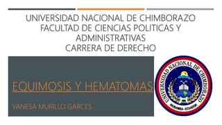 UNIVERSIDAD NACIONAL DE CHIMBORAZO
FACULTAD DE CIENCIAS POLITICAS Y
ADMINISTRATIVAS
CARRERA DE DERECHO
EQUIMOSIS Y HEMATOMAS
VANESA MURILLO GARCES
 