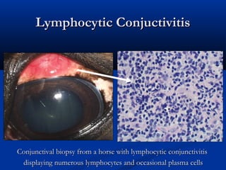 Lymphocytic ConjuctivitisLymphocytic Conjuctivitis
Conjunctival biopsy from a horse with lymphocytic conjunctivitisConjunc...