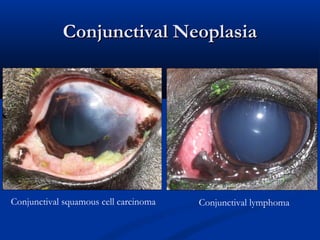 Conjunctival NeoplasiaConjunctival Neoplasia
Conjunctival squamous cell carcinoma Conjunctival lymphoma
 