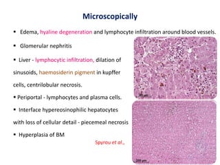 Microscopically
 Edema, hyaline degeneration and lymphocyte infiltration around blood vessels.
 Glomerular nephritis
 Liver - lymphocytic infiltration, dilation of
sinusoids, haemosiderin pigment in kupffer
cells, centrilobular necrosis.
 Periportal - lymphocytes and plasma cells.
 Interface hypereosinophilic hepatocytes
with loss of cellular detail - piecemeal necrosis
 Hyperplasia of BM
Spyrou et al.,
 