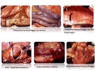 Petechial hemorrhages on serosa Petechial hemorrhages on the
diaphragm
AHS - Hydropericardium Subendocardial hemorrhagesSubcutaneous edema
 