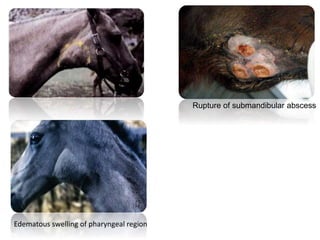 Edematous swelling of pharyngeal region
Rupture of submandibular abscess
 