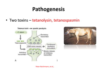 Pathogenesis
• Two toxins – tetanolysin, tetanospasmin
Peter Reichmann, et al.,
 
