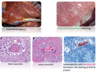 Interlobular edema Petechial hemorrhages over lung
Brain vasculitis ovary vasculitis Lymphadenitis with syncytial cell
formation. IHC staining of HeV N
protein
 