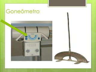 Goneômetro
 