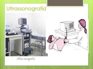 Ultrassonografia
 