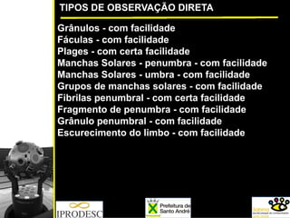 TIPOS DE OBSERVAÇÃO DIRETA
Grânulos - com facilidade
Fáculas - com facilidade
Plages - com certa facilidade
Manchas Solares - penumbra - com facilidade
Manchas Solares - umbra - com facilidade
Grupos de manchas solares - com facilidade
Fibrilas penumbral - com certa facilidade
Fragmento de penumbra - com facilidade
Grânulo penumbral - com facilidade
Escurecimento do limbo - com facilidade
 