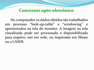 Conversor opto-eletrônico
No computador os dados obtidos são trabalhados
em processo “look-up-table” e “windowing” e
apresentados na tela do monitor. A imagem na tela
visualizada pode ser processada e disponibilizada
para arquivo, uso em rede, ou impressão em filmes
ou a LASER.
 