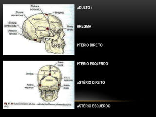 ADULTO :
BREGMA
PTÉRIO DIREITO
PTÉRIO ESQUERDO
ASTÉRIO DIREITO
ASTÉRIO ESQUERDO
 