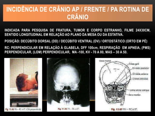 INCIDÊNCIA DE CRÂNIO AP / FRENTE / PA ROTINA DE
CRÂNIO
INDICADA PARA PESQUISA DE FRATURA, TUMOR E CORPO ESTRANHO, FILME 24X30CM,
SENTIDO LONGITUDINAL EM RELAÇÃO AO PLANO DA MESA OU DA ESTATIVA.
POSIÇÃO: DECÚBITO DORSAL (DD) / DECÚBITO VENTRAL (DV) / ORTOSTÁTICO (ORTO EM PÉ)
RC: PERPENDICULAR EM RELAÇÃO À GLABELA, DFF 100cm, RESPIRAÇÃO EM APNEIA, (PMS)
PERPENDICULAR, (LOM) PERPENDICULAR, MA -100, KV - 70 A 80, MAS – 30 A 50.
 