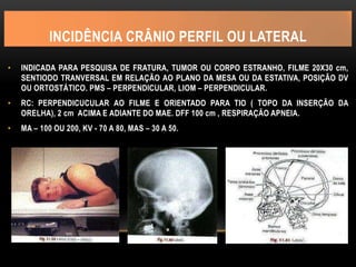 INCIDÊNCIA CRÂNIO PERFIL OU LATERAL
• INDICADA PARA PESQUISA DE FRATURA, TUMOR OU CORPO ESTRANHO, FILME 20X30 cm,
SENTIODO TRANVERSAL EM RELAÇÃO AO PLANO DA MESA OU DA ESTATIVA, POSIÇÃO DV
OU ORTOSTÁTICO. PMS – PERPENDICULAR, LIOM – PERPENDICULAR.
• RC: PERPENDICUCULAR AO FILME E ORIENTADO PARA TIO ( TOPO DA INSERÇÃO DA
ORELHA), 2 cm ACIMA E ADIANTE DO MAE. DFF 100 cm , RESPIRAÇÃO APNEIA.
• MA – 100 OU 200, KV - 70 A 80, MAS – 30 A 50.
 