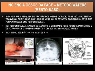 INCIÊNCIA OSSOS DA FACE – MÉTODO WATERS
(MENTO-NASO)
• INDICADA PARA PESQUISA DE FRATURA DOS OSSOS DA FACE, FILME 18X24cm, SENTIDO
TRANVESAL EM RELAÇÃO AO PLANO DA MESA OU DA ESTATIVA, POSIÇÃO DV / ORTO. PMS
PERPENDICULAR, LMM PERPENDICULAR.
• RC: PERPENDICULAR, SAINDO NO ACÂNTIO E ORIENTADO PELO PONTO EXATO ENTRE O
OSSO FRONTAL E OS OSSOS PARIENTAIS, DFF 100 cm, RESPIRAÇÃO APNEIA.
• MA – 200 OU 300, KV - 70 A 80, MAS – 25 A 30.
 