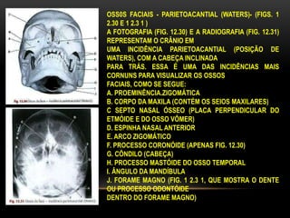 OSS0S FACIAIS - PARIETOACANTIAL (WATERS)- (FIGS. 1
2.30 E 1 2.3 1 )
A FOTOGRAFIA (FIG. 12.30) E A RADIOGRAFIA (FIG. 12.31)
REPRESENTAM O CRÂNIO EM
UMA INCIDÊNCIA PARIETOACANTIAL (POSIÇÃO DE
WATERS), COM A CABEÇA INCLINADA
PARA TRÁS. ESSA É UMA DAS INCIDÊNCIAS MAIS
CORNUNS PARA VISUALIZAR OS OSSOS
FACIAIS, COMO SE SEGUE:
A. PROEMINÊNCIA.ZIGOMÁTICA
B. CORPO DA MAXILA (CONTÉM OS SEIOS MAXILARES)
C SEPTO NASAL ÓSSEO (PLACA PERPENDICULAR DO
ETMÓIDE E DO OSSO VÔMER)
D. ESPINHA NASAL ANTERIOR
E. ARCO ZIGOMÁTICO
F. PROCESSO CORONÓIDE (APENAS FIG. 12.30)
G. CÔNDILO (CABEÇA)
H. PROCESSO MASTÓIDE DO OSSO TEMPORAL
I. ÂNGULO DA MANDÍBULA
J. FORAME MAGNO (FIG. 1 2.3 1, QUE MOSTRA O DENTE
OU PROCESSO ODONTÓIDE
DENTRO DO FORAME MAGNO)
 