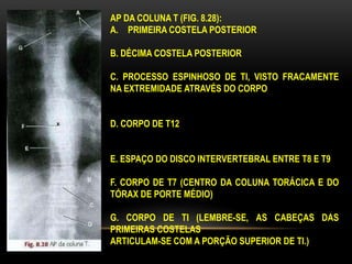 AP DA COLUNA T (FIG. 8.28):
A. PRIMEIRA COSTELA POSTERIOR
B. DÉCIMA COSTELA POSTERIOR
C. PROCESSO ESPINHOSO DE TI, VISTO FRACAMENTE
NA EXTREMIDADE ATRAVÉS DO CORPO
D. CORPO DE T12
E. ESPAÇO DO DISCO INTERVERTEBRAL ENTRE T8 E T9
F. CORPO DE T7 (CENTRO DA COLUNA TORÁCICA E DO
TÓRAX DE PORTE MÉDIO)
G. CORPO DE TI (LEMBRE-SE, AS CABEÇAS DAS
PRIMEIRAS COSTELAS
ARTICULAM-SE COM A PORÇÃO SUPERIOR DE TI.)
 