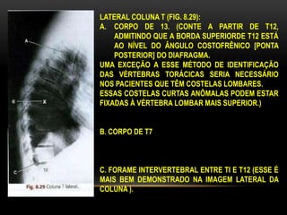 LATERAL COLUNA T (FIG. 8.29):
A. CORPO DE 13. (CONTE A PARTIR DE T12,
ADMITINDO QUE A BORDA SUPERIORDE T12 ESTÁ
AO NÍVEL DO ÂNGULO COSTOFRÊNICO [PONTA
POSTERIOR] DO DIAFRAGMA.
UMA EXCEÇÃO A ESSE MÉTODO DE IDENTIFICAÇÃO
DAS VÉRTEBRAS TORÁCICAS SERIA NECESSÁRIO
NOS PACIENTES QUE TÊM COSTELAS LOMBARES.
ESSAS COSTELAS CURTAS ANÔMALAS PODEM ESTAR
FIXADAS À VÉRTEBRA LOMBAR MAIS SUPERIOR.)
B. CORPO DE T7
C. FORAME INTERVERTEBRAL ENTRE TI E T12 (ESSE É
MAIS BEM DEMONSTRADO NA IMAGEM LATERAL DA
COLUNA ).
 