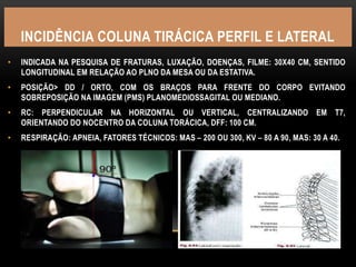 INCIDÊNCIA COLUNA TIRÁCICA PERFIL E LATERAL
• INDICADA NA PESQUISA DE FRATURAS, LUXAÇÃO, DOENÇAS, FILME: 30X40 CM, SENTIDO
LONGITUDINAL EM RELAÇÃO AO PLNO DA MESA OU DA ESTATIVA.
• POSIÇÃO> DD / ORTO, COM OS BRAÇOS PARA FRENTE DO CORPO EVITANDO
SOBREPOSIÇÃO NA IMAGEM (PMS) PLANOMEDIOSSAGITAL OU MEDIANO.
• RC: PERPENDICULAR NA HORIZONTAL OU VERTICAL, CENTRALIZANDO EM T7,
ORIENTANDO DO NOCENTRO DA COLUNA TORÁCICA, DFF: 100 CM.
• RESPIRAÇÃO: APNEIA, FATORES TÉCNICOS: MAS – 200 OU 300, KV – 80 A 90, MAS: 30 A 40.
 