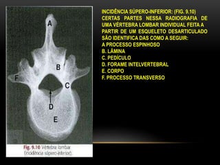 INCIDÊNCIA SÚPERO-INFERIOR: (FIG. 9.10)
CERTAS PARTES NESSA RADIOGRAFIA DE
UMA VÉRTEBRA LOMBAR INDIVIDUAL FEITA A
PARTIR DE UM ESQUELETO DESARTICULADO
SÃO IDENTIFICA DAS COMO A SEGUIR:
A PROCESSO ESPINHOSO
B. LÂMINA
C. PEDÍCULO
D. FORAME INTELVERTEBRAL
E. CORPO
F. PROCESSO TRANSVERSO
 