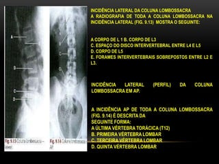 INCIDÊNCIA LATERAL DA COLUNA LOMBOSSACRA
A RADIOGRAFIA DE TODA A COLUNA LOMBOSSACRA NA
INCIDÊNCIA LATERAL (FIG. 9.13) MOSTRA O SEGUINTE:
A CORPO DE L 1 B. CORPO DE L3
C. ESPAÇO DO DISCO INTERVERTEBRAL ENTRE L4 E L5
D. CORPO DE L5
E. FORAMES INTERVERTEBRAIS SOBREPOSTOS ENTRE L2 E
L3.
INCIDÊNCIA LATERAL (PERFIL) DA COLUNA
LOMBOSSACRA EM AP.
A INCIDÊNCIA AP DE TODA A COLUNA LOMBOSSACRA
(FIG. 9.14) É DESCRITA DA
SEGUINTE FORMA:
A ÚLTIMA VÉRTEBRA TORÁCICA (T12)
B. PRIMEIRA VÉRTEBRA LOMBAR
C. TERCEIRA VÉRTEBRA LOMBAR
D. QUINTA VÉRTEBRA LOMBAR
 