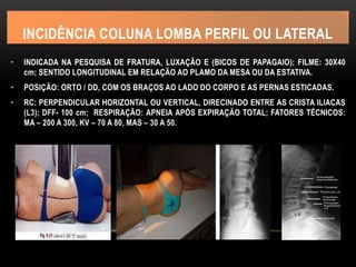 INCIDÊNCIA COLUNA LOMBA PERFIL OU LATERAL
• INDICADA NA PESQUISA DE FRATURA, LUXAÇÃO E (BICOS DE PAPAGAIO); FILME: 30X40
cm; SENTIDO LONGITUDINAL EM RELAÇÃO AO PLAMO DA MESA OU DA ESTATIVA.
• POSIÇÃO: ORTO / DD, COM OS BRAÇOS AO LADO DO CORPO E AS PERNAS ESTICADAS.
• RC: PERPENDICULAR HORIZONTAL OU VERTICAL, DIRECINADO ENTRE AS CRISTA ILIACAS
(L3); DFF- 100 cm; RESPIRAÇÃO: APNEIA APÓS EXPIRAÇÃO TOTAL; FATORES TÉCNICOS:
MA – 200 A 300, KV – 70 A 80, MAS – 30 A 50.
 
