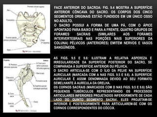 FACE ANTERIOR DO SACROA: FIG. 9.4 MOSTRA A SUPERFÍCIE
ANTERIOR CÔNCAVA DO SACRO. OS CORPOS DOS CINCO
SEGMENTOS ORIGINAIS ESTÃO FUNDIDOS EM UM ÚNICO OSSO
NO ADULTO.
O SACRO POSSUI A FORMA DE UMA PÁ, COM O ÁPICE
APONTADO PARA BAIXO E PARA A FRENTE. QUATRO GRUPOS DE
FORAMES SACRAIS (SIMILARES AOS FORAMES
INTERVERTEBRAIS NAS PORÇÕES MAIS SUPERIORES DA
COLUNA) PÉLVICOS (ANTERIORES) EMITEM NERVOS E VASOS
SANGÜÍNEOS.
AS FIGS. 9.5 E 9.6: ILUSTRAM A RELATIVA ASPEREZA E
IRREGULARIDADE DA SUPERFÍCIE POSTERIOR DO SACRO, SE
COMPARADA À SUPERFÍCIE ANTERIOR OU PÉLVICA.
O SACRO ARTICULA-SE COM O ÍLIO DA PELVE NA SUPERFÍCIE
AURICULAR (MARCADA COM A NAS FIGS. 9.5 E 9.6). A SUPERFÍCIE
AURICULAR É ASSIM DENOMINADA DEVIDO AO SEU FORMATO
SEMELHANTE À AURÍCULA DA ORELHA.
OS CORNOS SACRAIS (MARCADOS COM D NAS FIGS. 9.5 E 9.6) SÃO
PEQUENOS TUBÉRCULOS REPRESENTANDO OS PROCESSOS
ARTICULARES INFERIORES PROJETADOS INFERIORMENTE DE CADA
LADO DO QUINTO SEGMENTO SACRA!. ELES PROJETAM-SE
INFERIOR E POSTERIORMENTE PARA ARTICULAREM-SE COM OS
CORNOS CORRESPONDENTES DO CÓCCIX.
 