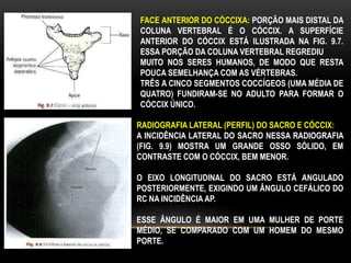 FACE ANTERIOR DO CÓCCIXA: PORÇÃO MAIS DISTAL DA
COLUNA VERTEBRAL É O CÓCCIX. A SUPERFÍCIE
ANTERIOR DO CÓCCIX ESTÁ ILUSTRADA NA FIG. 9.7.
ESSA PORÇÃO DA COLUNA VERTEBRAL REGREDIU
MUITO NOS SERES HUMANOS, DE MODO QUE RESTA
POUCA SEMELHANÇA COM AS VÉRTEBRAS.
TRÊS A CINCO SEGMENTOS COCCÍGEOS (UMA MÉDIA DE
QUATRO) FUNDIRAM-SE NO ADULTO PARA FORMAR O
CÓCCIX ÚNICO.
RADIOGRAFIA LATERAL (PERFIL) DO SACRO E CÓCCIX:
A INCIDÊNCIA LATERAL DO SACRO NESSA RADIOGRAFIA
(FIG. 9.9) MOSTRA UM GRANDE OSSO SÓLIDO, EM
CONTRASTE COM O CÓCCIX, BEM MENOR.
O EIXO LONGITUDINAL DO SACRO ESTÁ ANGULADO
POSTERIORMENTE, EXIGINDO UM ÂNGULO CEFÁLICO DO
RC NA INCIDÊNCIA AP.
ESSE ÂNGULO É MAIOR EM UMA MULHER DE PORTE
MÉDIO, SE COMPARADO COM UM HOMEM DO MESMO
PORTE.
 