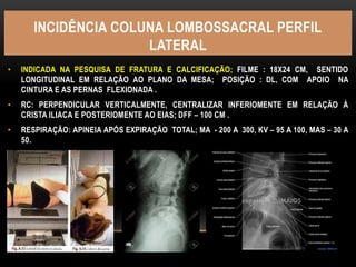 INCIDÊNCIA COLUNA LOMBOSSACRAL PERFIL
LATERAL
• INDICADA NA PESQUISA DE FRATURA E CALCIFICAÇÃO; FILME : 18X24 CM, SENTIDO
LONGITUDINAL EM RELAÇÃO AO PLANO DA MESA; POSIÇÃO : DL, COM APOIO NA
CINTURA E AS PERNAS FLEXIONADA .
• RC: PERPENDICULAR VERTICALMENTE, CENTRALIZAR INFERIOMENTE EM RELAÇÃO À
CRISTA ILIACA E POSTERIOMENTE AO EIAS; DFF – 100 CM .
• RESPIRAÇÃO: APINEIA APÓS EXPIRAÇÃO TOTAL; MA - 200 A 300, KV – 95 A 100, MAS – 30 A
50.
 