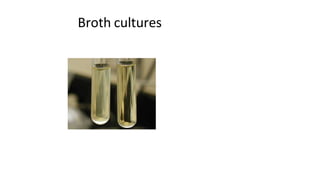 Broth cultures
 