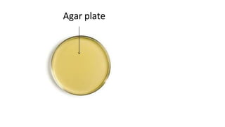 Agar plate
 