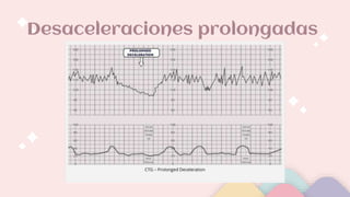 Desaceleraciones prolongadas
 