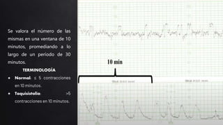 Se valora el número de las
mismas en una ventana de 10
minutos, promediando a lo
largo de un período de 30
minutos.
TERMINOLOGÍA
● Normal: ≤ 5 contracciones
en 10 minutos.
● Taquisistolia: >5
contracciones en 10 minutos.
 