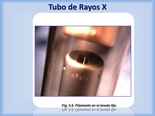 Tubo de Rayos X 
 