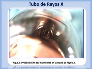 Tubo de Rayos X 
 
