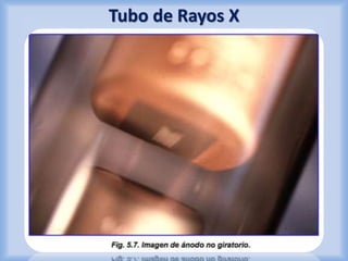 Tubo de Rayos X 
 