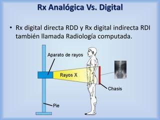 Rx Analógica Vs. Digital 
• Rx digital directa RDD y Rx digital indirecta RDI 
también llamada Radiología computada. 
 