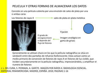 PELICULA Y OTRAS FORMAS DE ALMACENAR LOS DATOS 
Consiste en una película cubierta por una emulsión de sales de plata por una 
o ambas caras 
Los fotones de rayos X sales de plata en plata metálica 
Fijación 
Imagen analógica en 
gama de grises 
El grado de 
ennegrecimient 
o depende del 
flujo de fotones 
Generalmente se utilizan chasis en los que la película radiográfica se sitúa en 
sándwich entre dos pantallas de refuerzo fosforescente. Estas actúan como un 
medio primario de conversión de fotones de rayos X en fotones de luz visible, que 
inciden secundariamente en la película radiográfica, impresionándola, y amplificar el 
numero de fotones 
J. L. DEL CURA, S. PEDRAZA, A. GAYETE. IMAGEN POR RAYOS X. RADIOLOGIA ESENCIAL. 
EDITORIAL PANAMERICANA. MADRID, ESPAÑA. 2010; PAGINAS 1-16 
 