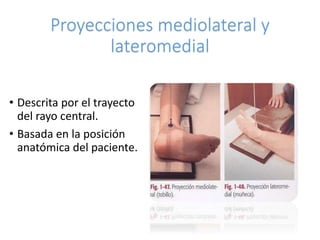 Proyecciones mediolateral y 
lateromedial 
• Descrita por el trayecto 
del rayo central. 
• Basada en la posición 
anatómica del paciente. 
 