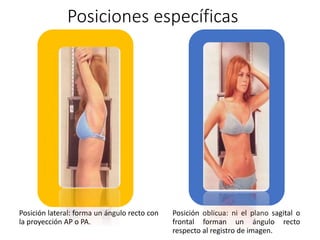 Posiciones específicas 
Posición lateral: forma un ángulo recto con 
la proyección AP o PA. 
Posición oblicua: ni el plano sagital o 
frontal forman un ángulo recto 
respecto al registro de imagen. 
 