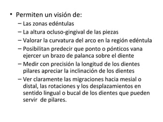 • Permiten un visión de:
  – Las zonas edéntulas
  – La altura ocluso-gingival de las piezas
  – Valorar la curvatura del arco en la región edéntula
  – Posibilitan predecir que ponto o pónticos vana
    ejercer un brazo de palanca sobre el diente
  – Medir con precisión la longitud de los dientes
    pilares apreciar la inclinación de los dientes
  – Ver claramente las migraciones hacia mesial o
    distal, las rotaciones y los desplazamientos en
    sentido lingual o bucal de los dientes que pueden
    servir de pilares.
 