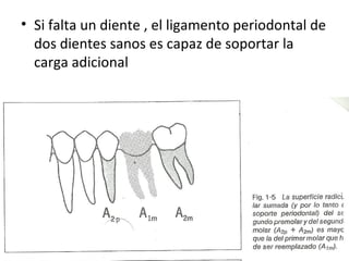 • Si falta un diente , el ligamento periodontal de
  dos dientes sanos es capaz de soportar la
  carga adicional




•FIG. 1-5
 