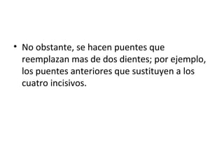 • No obstante, se hacen puentes que
  reemplazan mas de dos dientes; por ejemplo,
  los puentes anteriores que sustituyen a los
  cuatro incisivos.
 