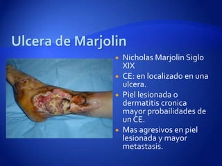    Nicholas Marjolin Siglo
    XIX
   CE: en localizado en una
    ulcera.
   Piel lesionada o
    dermatitis cronica
    mayor probailidades de
    un CE.
   Mas agresivos en piel
    lesionada y mayor
    metastasis.
 
